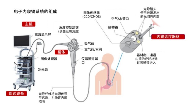 电子内窥镜系统的组成